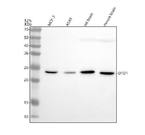 Western blot analysis of DTD1 using anti-DTD1 antibody (A07679-1)