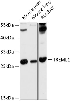 Western blot analysis of extracts of various cell lines, using TREML1 antibody  at 1:1000 dilution