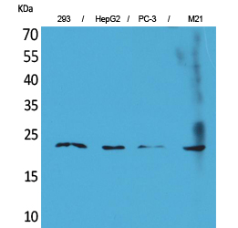 Western Blot analysis of 293, HepG2, PC-3, M21 cells using FGF-6 Polyclonal Antibody