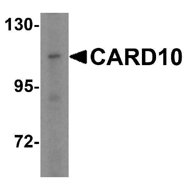 Western blot analysis of CARD10 in A-20 cell lysate with CARD10 antibody at 5 μg/mL
