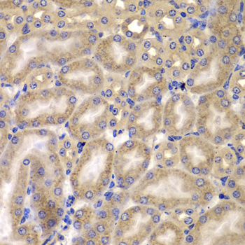 Immunohistochemistry of paraffin-embedded mouse kidney using CARD10 antibody  at dilution of 1:100 