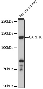 Western blot analysis of extracts of Mouse kidney, using CARD10 antibody  at 1:500 dilution