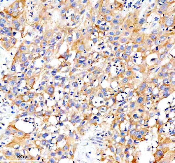  IHC analysis of CARD10 using anti-CARD10 antibody (A07686-4)