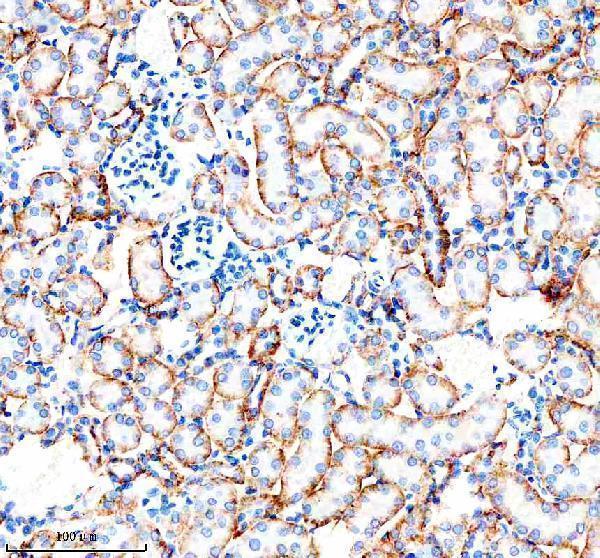  IHC analysis of CARD10 using anti-CARD10 antibody (A07686-4)
