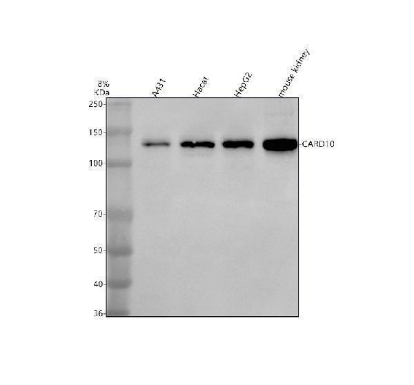  Western blot analysis of CARD10 using anti-CARD10 antibody (A07686-4)