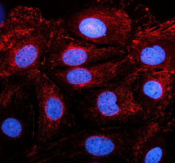 a07688 2 gpa33 primary antibodies if testing 2