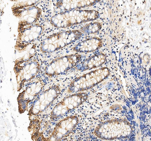 a07688 2 gpa33 primary antibodies ihc testing 2