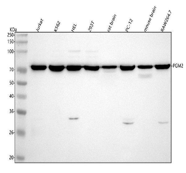  Western blot analysis of PGM2 using anti-PGM2 antibody (A07690-1)