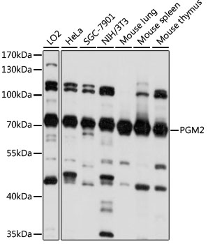Western blot analysis of extracts of various cell lines, using PGM2 antibody  at 1:1000 dilution
