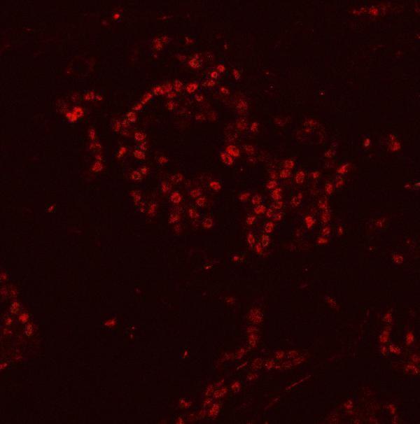 a07691 hnrnph1 primary antibodies if testing 14
