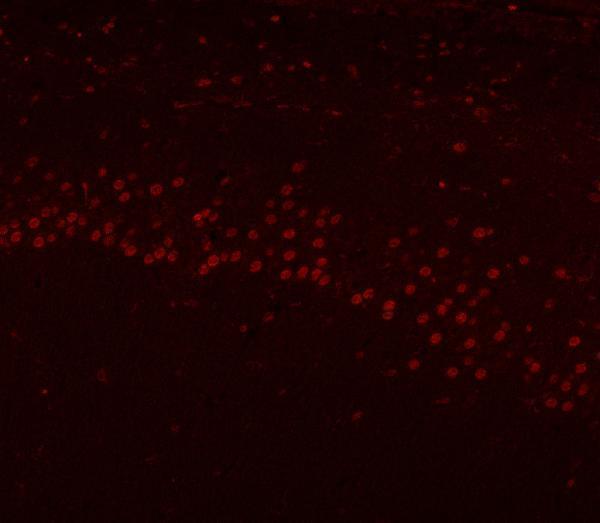 a07691 hnrnph1 primary antibodies if testing 15