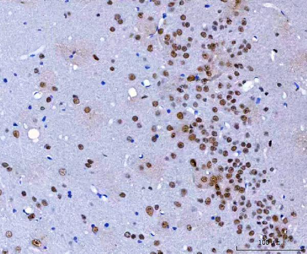 a07691 hnrnph1 primary antibodies ihc testing 10