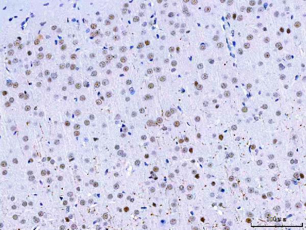 a07691 hnrnph1 primary antibodies ihc testing 11