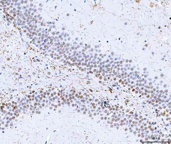 a07691 hnrnph1 primary antibodies ihc testing 12