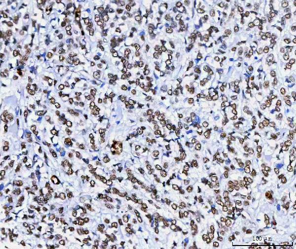 a07691 hnrnph1 primary antibodies ihc testing 2
