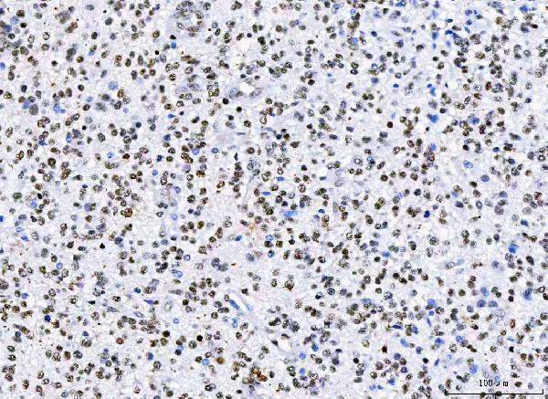 a07691 hnrnph1 primary antibodies ihc testing 3