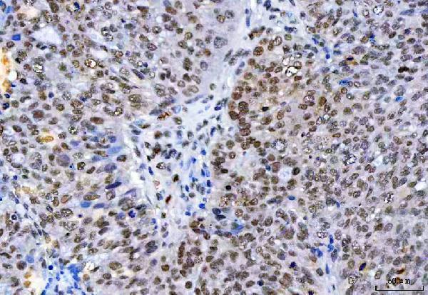 a07691 hnrnph1 primary antibodies ihc testing 4