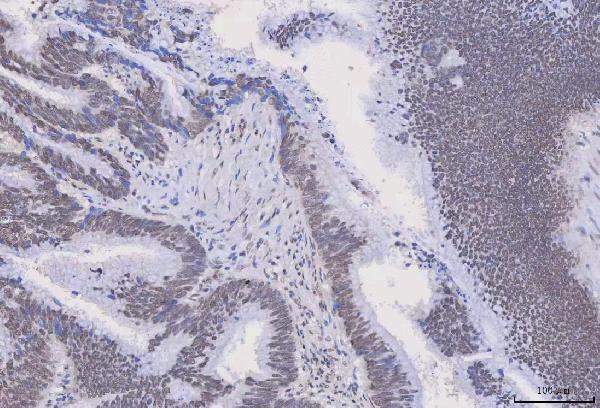 a07691 hnrnph1 primary antibodies ihc testing 5