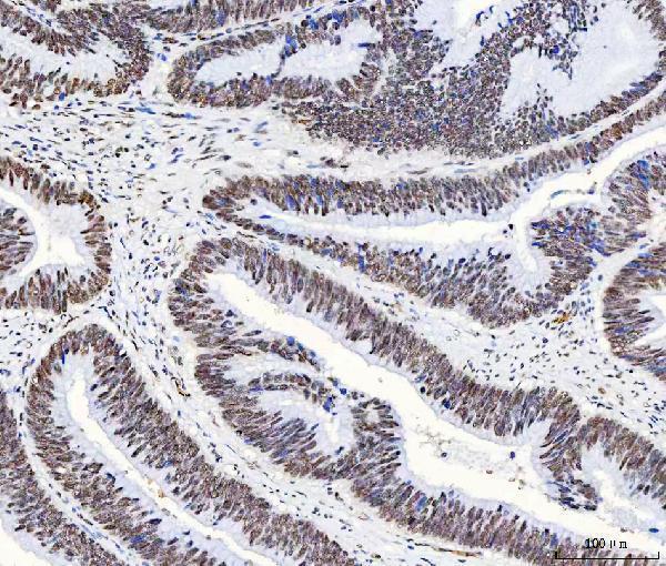 a07691 hnrnph1 primary antibodies ihc testing 6