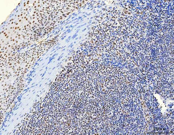a07691 hnrnph1 primary antibodies ihc testing 7