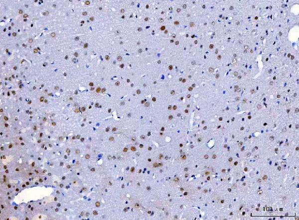 a07691 hnrnph1 primary antibodies ihc testing 8
