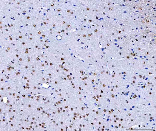 a07691 hnrnph1 primary antibodies ihc testing 9