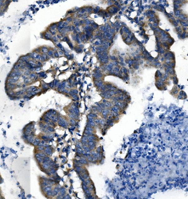  IHC analysis of SLC18A1 using anti-SLC18A1 antibody (A07692-1)