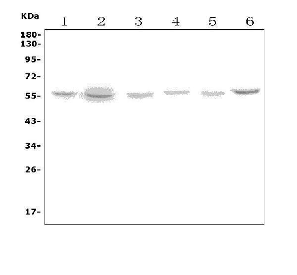  Western blot analysis of SLC18A1 using anti-SLC18A1 antibody (A07692-1)