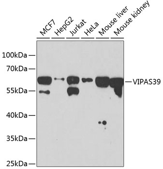 Western blot analysis of extracts of various cell lines, using VIPAS39 antibody  at 1:1000 dilution