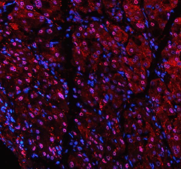 a07697 1 psmb2 primary antibodies if testing 1