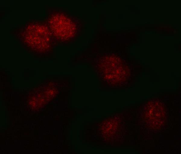  IF analysis of PSMB2 using anti-PSMB2 antibody (A07697-1)