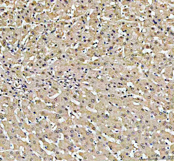 IHC analysis of PSMB2 using anti-PSMB2 antibody (A07697-1)