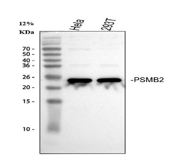  Western blot analysis of PSMB2 using anti-PSMB2 antibody (A07697-1)