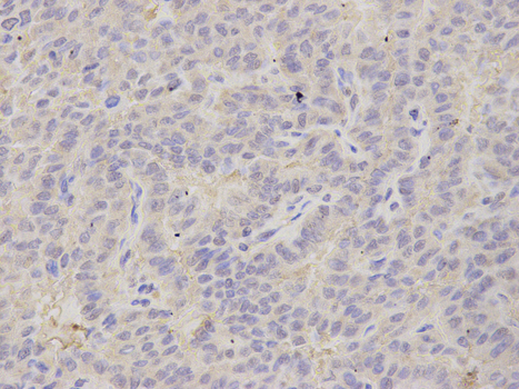 a07697 psmb2 primary antiboties ihc testing 2