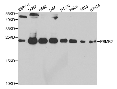 a07697 psmb2 primary antiboties wb testing 1