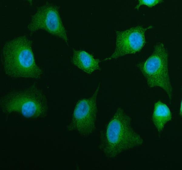 a07698 2 dctn2 primary antibodies if testing 1