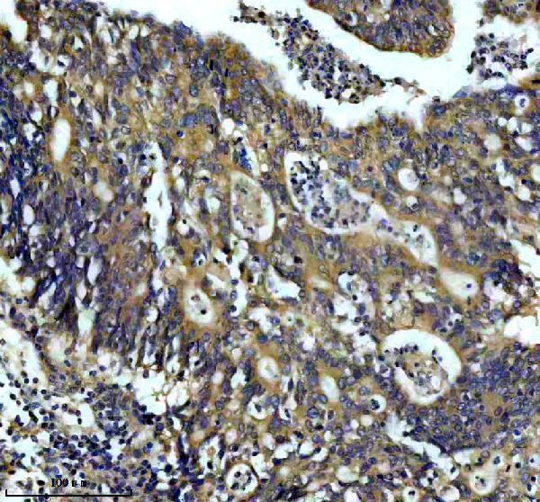 a07698 2 dctn2 primary antibodies ihc testing 1