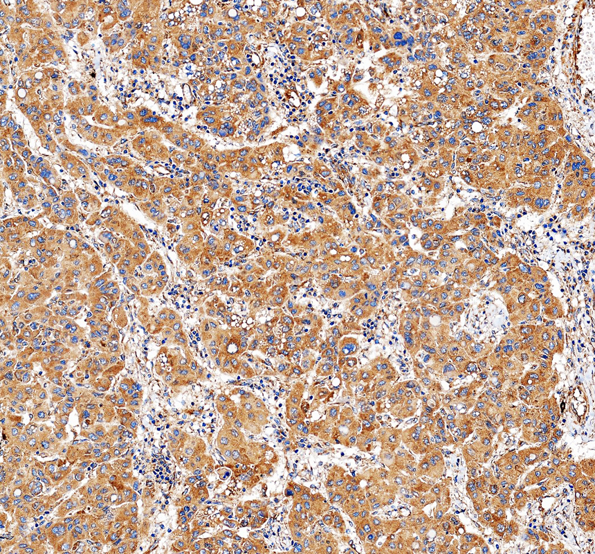 a07698 2 dctn2 primary antibodies ihc testing 2