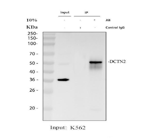 a07698 2 dctn2 primary antibodies ip testing 1