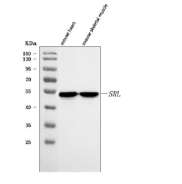  Western blot analysis of Sarcalumenin/Srl using anti-Sarcalumenin/Srl antibody (A07699-4)