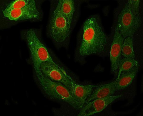  IF analysis of RFC4 using anti-RFC4 antibody (A07702-1) and anti-Beta Tubulin antibody (M01857-3)