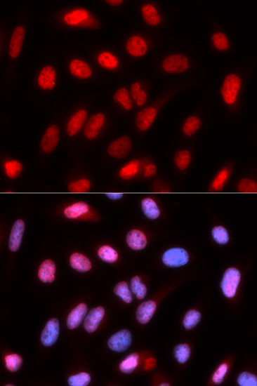 Immunofluorescence analysis of U2OS cells using RFC4 antibody 