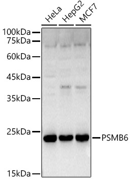 a07705 psmb6 primary antiboties wb testing 1