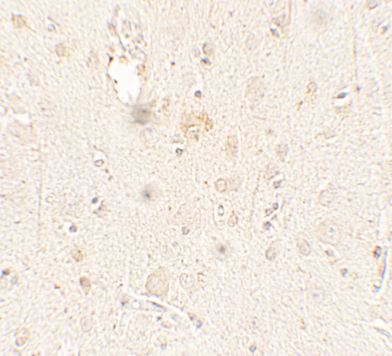 a07706 ulk3 primary antibodies ihc testing 2