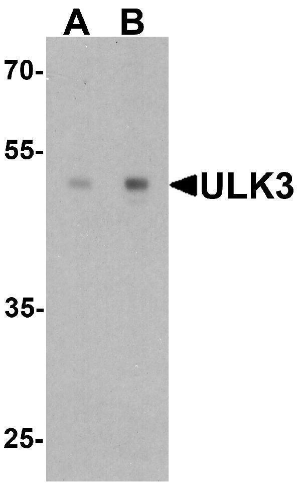 a07706 ulk3 primary antibodies wb testing 1