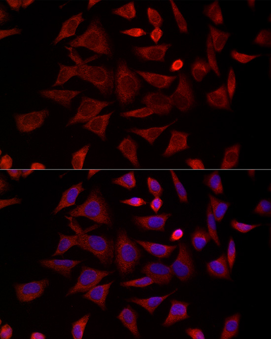 Immunofluorescence analysis of HeLa cells using CCT4 Rabbit pAb  at dilution of 1:300 