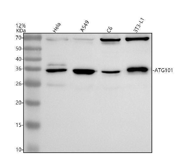 Western blot analysis of ATG101 using anti-ATG101 antibody (A07713-2)