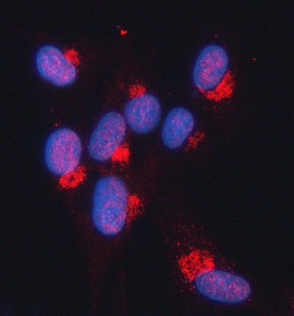  IF analysis of SNURPORTIN1/SNUPN using anti-SNURPORTIN1/SNUPN antibody (A07714-1)