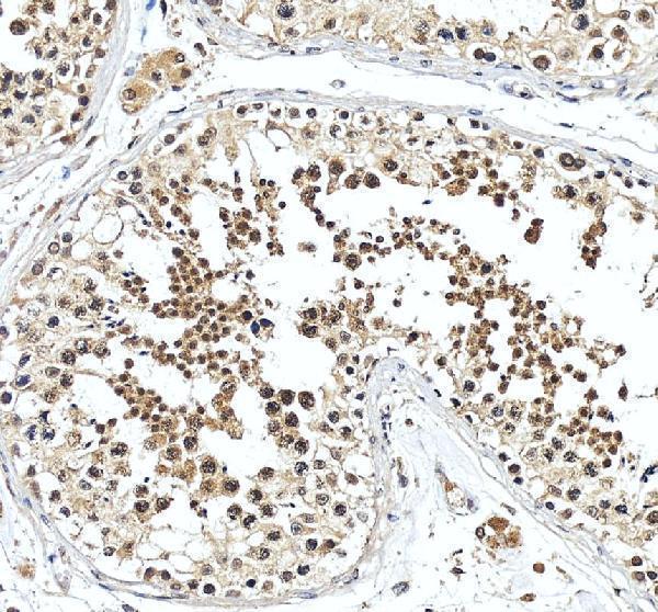 IHC analysis of SNUPN using anti-SNUPN antibody (A07714-1)