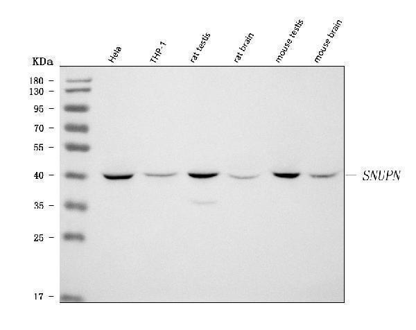  Western blot analysis of SNURPORTIN1/SNUPN using anti-SNURPORTIN1/SNUPN antibody (A07714-1)